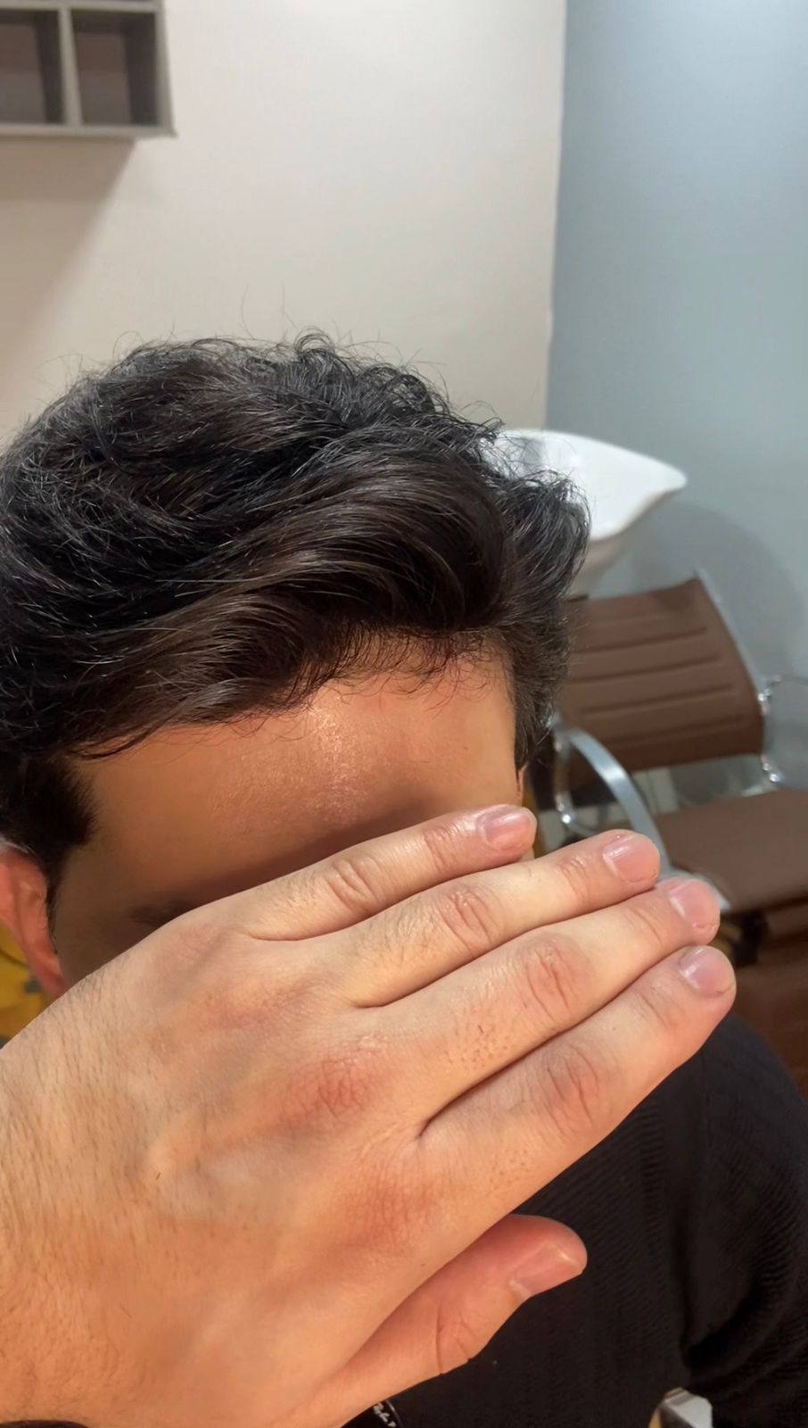 Depois da prótese capilar — Cliente real